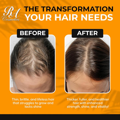 RA COSMETICS 100% Natural Unrefined Batana Hair Oil for Growth, Repair & Strength | 8 oz Nourishing Moisturizer for Damaged Hair from Honduras