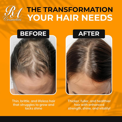 RA COSMETICS 100% Natural Unrefined Batana Hair Oil for Growth, Repair & Strength | 8 oz Nourishing Moisturizer for Damaged Hair from Honduras